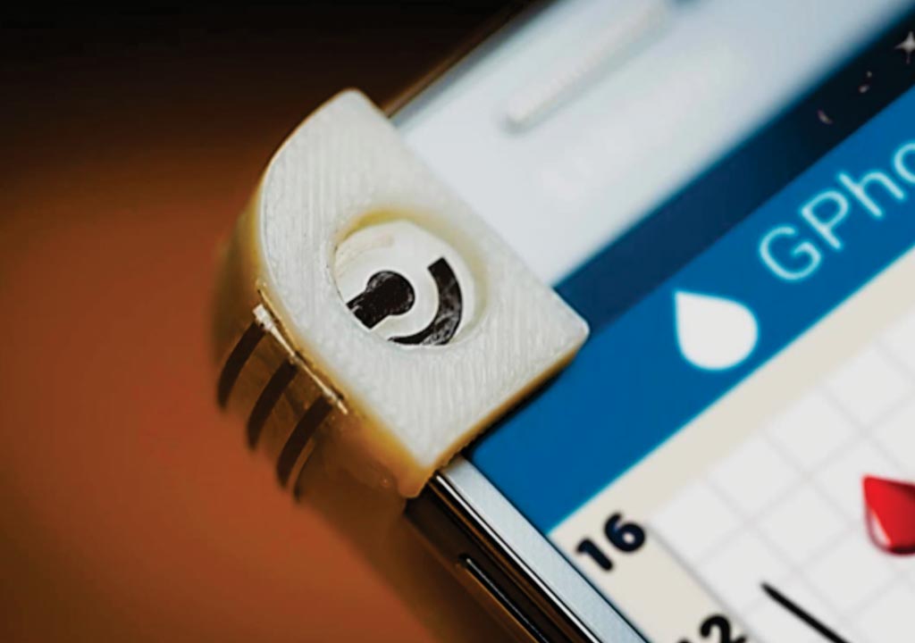 Imagen: El GPhone es un sistema portátil de detección de glucosa integrado en un teléfono inteligente (Fotografía cortesía de David Baillot /Facultad de Ingeniería Jacobs en la UC San Diego).