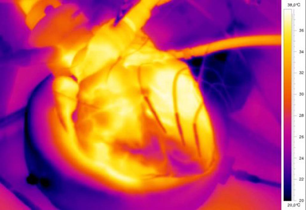 Imagen: Una imagen térmica de un corazón enfriado localizado (mancha oscura) (Fotografía cortesía del Hospital Catharina).