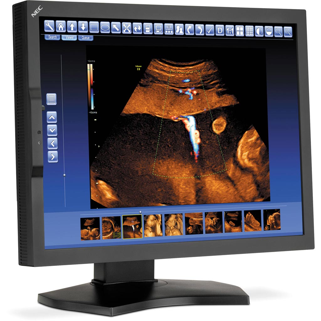 Imagen: Una pantalla LCD con pantalla retroiluminada por LED (Fotografía cortesía de NEC Display Solutions).