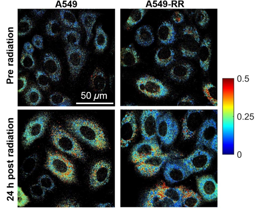 Imagen: Cambios en el metabolismo celular reflejados en las imágenes de autofluorescencia (Fotografía cortesía de la Universidad de Arkansas). Imagen: Cambios en el metabolismo celular reflejados en las imágenes de autofluorescencia (Fotografía cortesía de la Universidad de Arkansas).