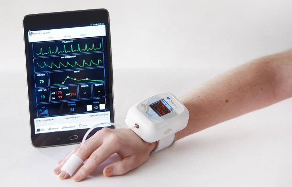 Imagen: El monitor inalámbrico de signos vitales Caretaker4 CNIBP con manguito desechable para los dedos (Fotografía cortesía de Caretaker Medical).