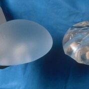 Imagen: Los implantes mamarios de silicona y solución salina mostrados uno al lado del otro (Fotografía cortesía de Science Photo Library).