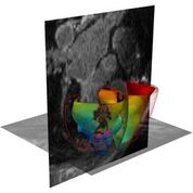 Imagen: Un corazón virtual simulado en 3D (Fotografía cortesía de la JHU). Imagen: Un corazón virtual simulado en 3D (Fotografía cortesía de la JHU).