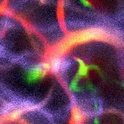 Imagen: Vasculatura cerebral en un ratón anestesiado observada usando Pysight (Fotografía cortesía de Pablo Blinder/TAU). Imagen: Vasculatura cerebral en un ratón anestesiado observada usando Pysight (Fotografía cortesía de Pablo Blinder/TAU).
