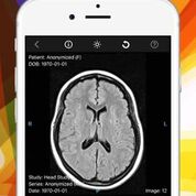 Imagen: una nueva aplicación permite ver imágenes médicas en un iPhone (Fotografía cortesía de Ambra Health).