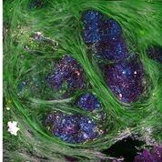 Imagen: La imagenología sin etiqueta del microambiente tumoral puede proporcionar una visualización en tiempo real de las características estructurales y moleculares, incluidos las VE (Fotografía cortesía de UIUC).