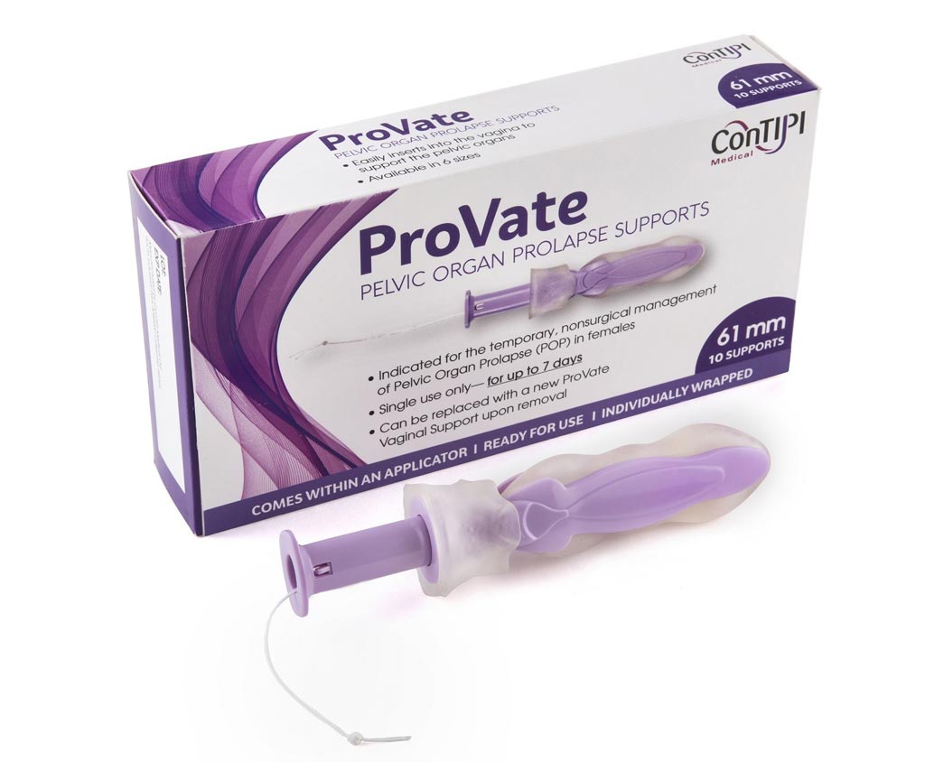Imagen: El ProVate desechable fue diseñado para ayudar a tratar el prolapso pélvico (Fotografía cortesía de ConTIPI Medical).