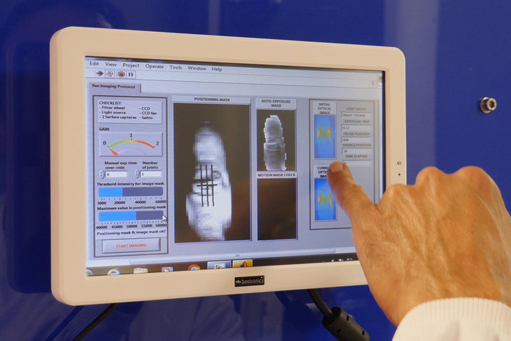 Imagen: La investigación muestra que la espectroscopia IR puede ayudar a identificar la artritis reumatoide (Fotografía cortesía de la UB). Imagen: La investigación muestra que la espectroscopia IR puede ayudar a identificar la artritis reumatoide (Fotografía cortesía de la UB).