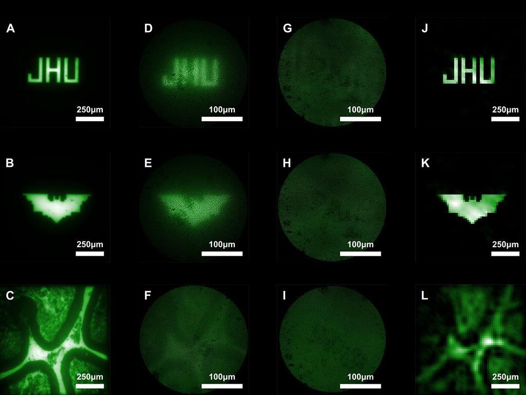 Imagen: Imágenes capturadas con endoscopios en miniatura convencionales y el nuevo microendoscopio sin lente (Fotografía cortesía de Mark Foster/JHU) Imagen: Imágenes capturadas con endoscopios en miniatura convencionales y el nuevo microendoscopio sin lente (Fotografía cortesía de Mark Foster/JHU)