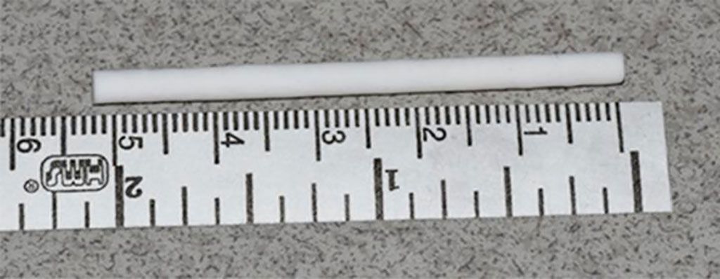 Imagen: La guía nerviosa liberadora de GDNF de 5,2 cm (Fotografía cortesía de la Universidad de Pittsburgh)