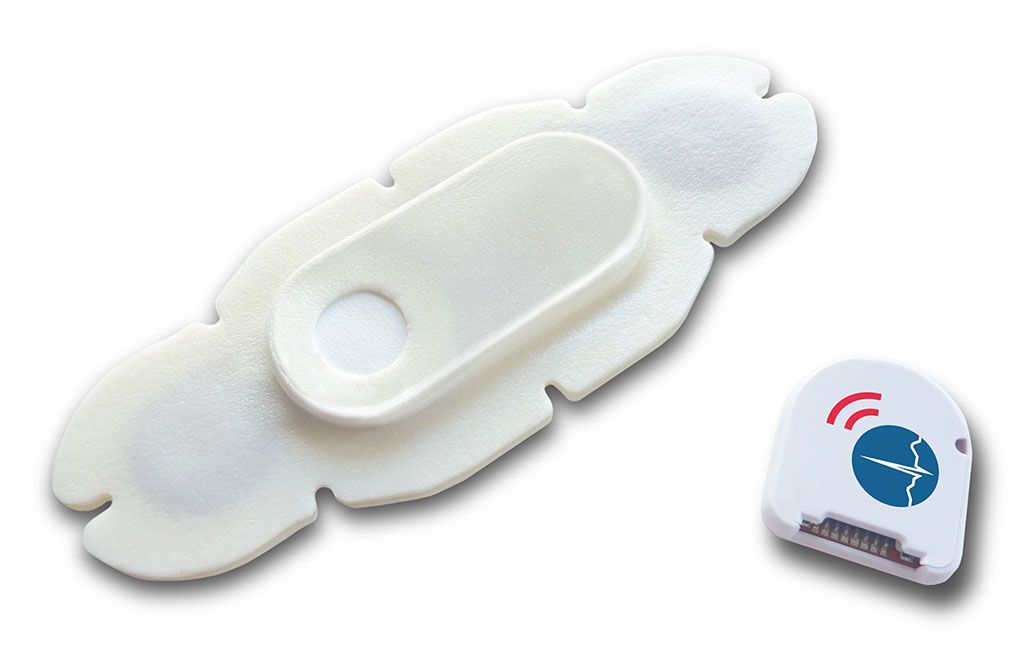 Imagen: El sensor portátil HealthPatch MD utilizado en el estudio (Fotografía  cortesía de Vital Connect)