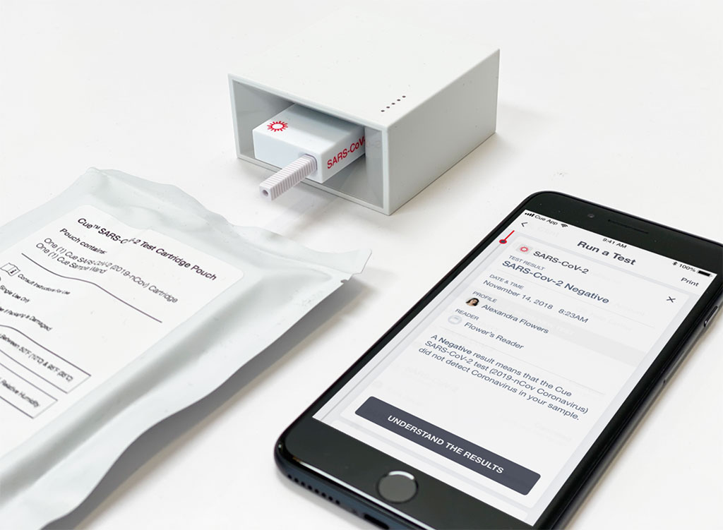 Imagen: El Sistema de Monitorización de Salud de Cue (Fotografía cortesía de Cue Health Inc.)
