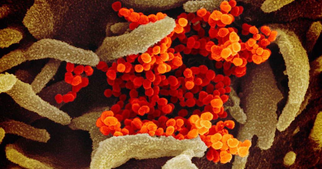 Imagen: Esta imagen de microscopio electrónico de barrido muestra el SARS-CoV-2 (naranja) aislado de un paciente en los EUA, emergiendo de la superficie de las células (verde) cultivadas en el laboratorio (Fotografía cortesía de NIAID-RML)