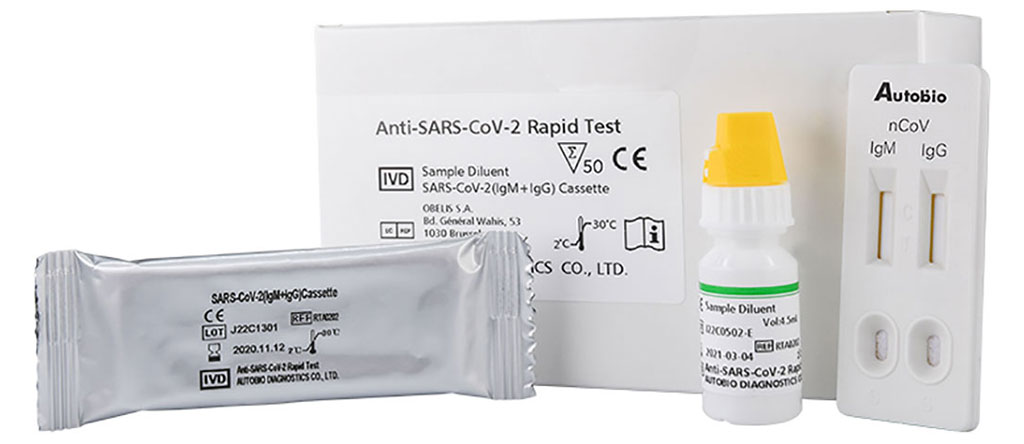 Imagen: Prueba rápida Anti-SARS-CoV-2 de Hardy Diagnostics (Fotografía cortesía de Hardy Diagnostics)