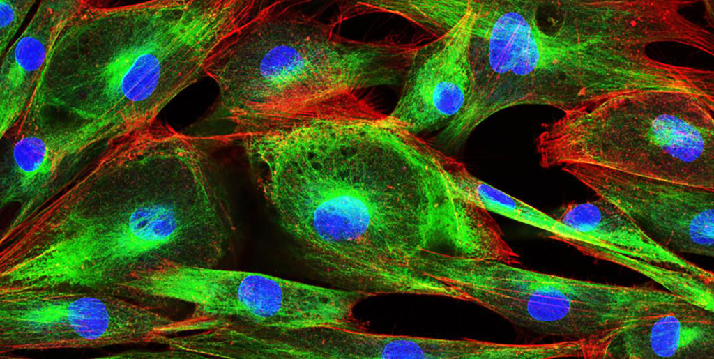 Imagen: Células de fibroblastos (Fotografía cortesía de FibroGenesis)