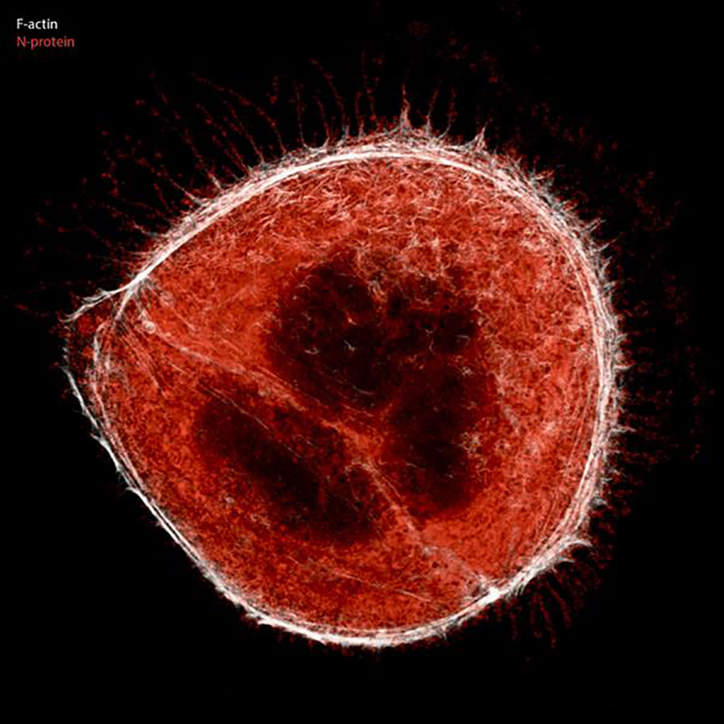 Imagen: Imagen de microscopía de fluorescencia de un grupo de dos células de células Caco-2 (células de colon humano) infectadas con el virus SARS-CoV-2. Las células infectadas producen protuberancias de filopodia (blancas) que se extienden desde la superficie celular que contiene partículas virales (proteína M en rojo) (Fotografía cortesía del Dr. Robert Grosse, CIBSS, Universidad de Friburgo)