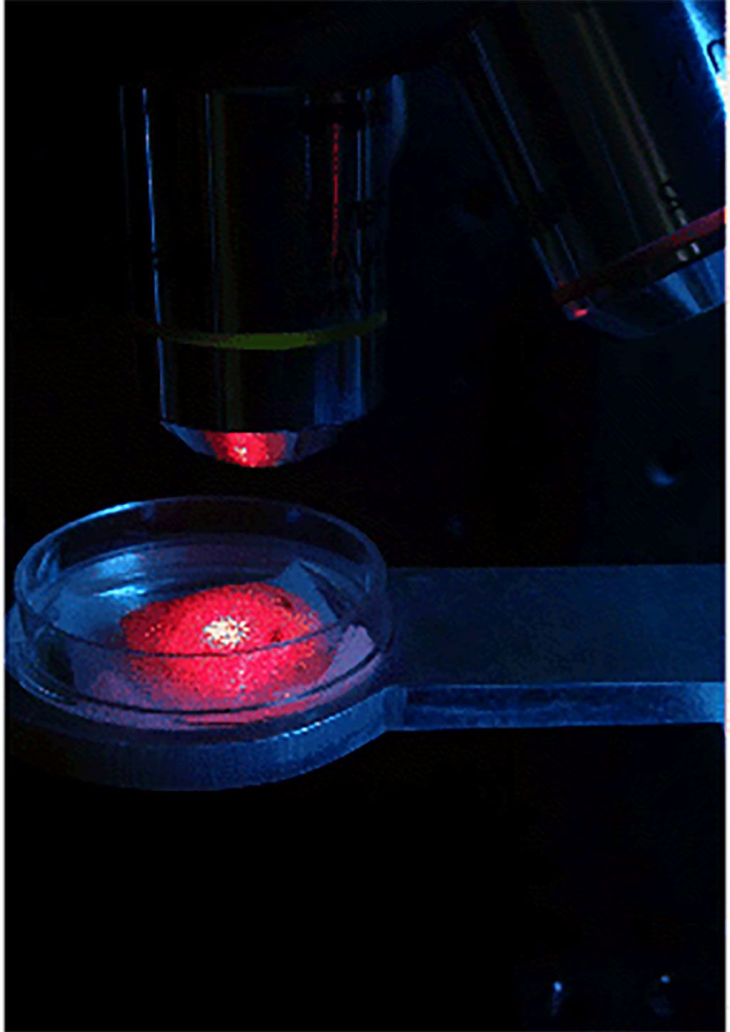 Imagen: La reología moteada con láser puede detectar la viscosidad de la sangre en el sitio (Fotografía cortesía de Nadkarni lab/ MGH)