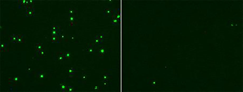 Imagen: La infección por SARS-CoV-2 (verde, izquierda) es inhibida por el tratamiento con 25HC (derecha) (Fotografía cortesía de UC San Diego Health)