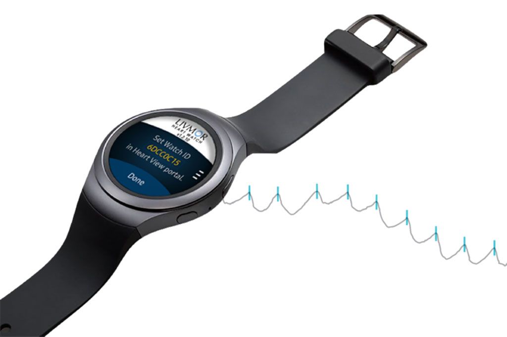 Imagen: El Sistema de Detección Halo FA en un reloj inteligente Samsung (Fotografía cortesía de Livmor)