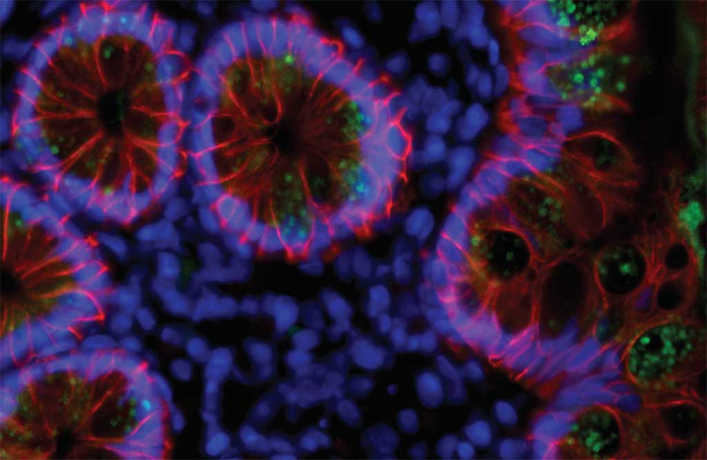 Imagen: Los científicos encontraron rastros de SARS-CoV-2 (verde) en las células que recubren los intestinos de las personas, tres meses después de la infección. Los anticuerpos pueden evolucionar en respuesta a estos rastros virales residuales (Fotografía cortesía de C. Gaebler et al)