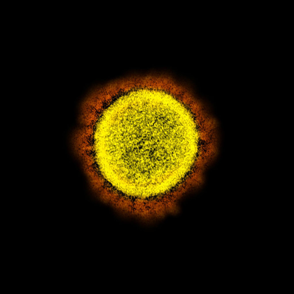 Imagen: Esta microfotografía electrónica de transmisión coloreada muestra una partícula de virus SARS-CoV-2, aislada de un paciente (Fotografía cortesía del NIAID)