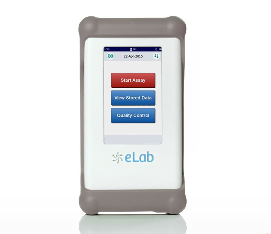 Imagen: La plataforma de análisis móvil Nanomix eLab® (Fotografía cortesía de Nanōmix, Inc.)