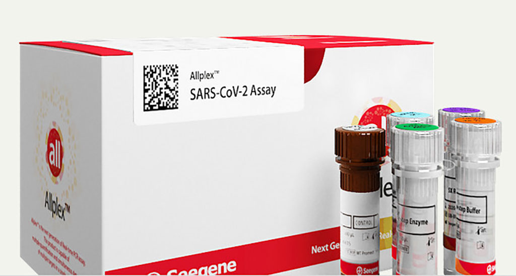 Imagen: Ensayo Allplex SARS-CoV-2 (Fotografía cortesía de Seegene, Inc.)