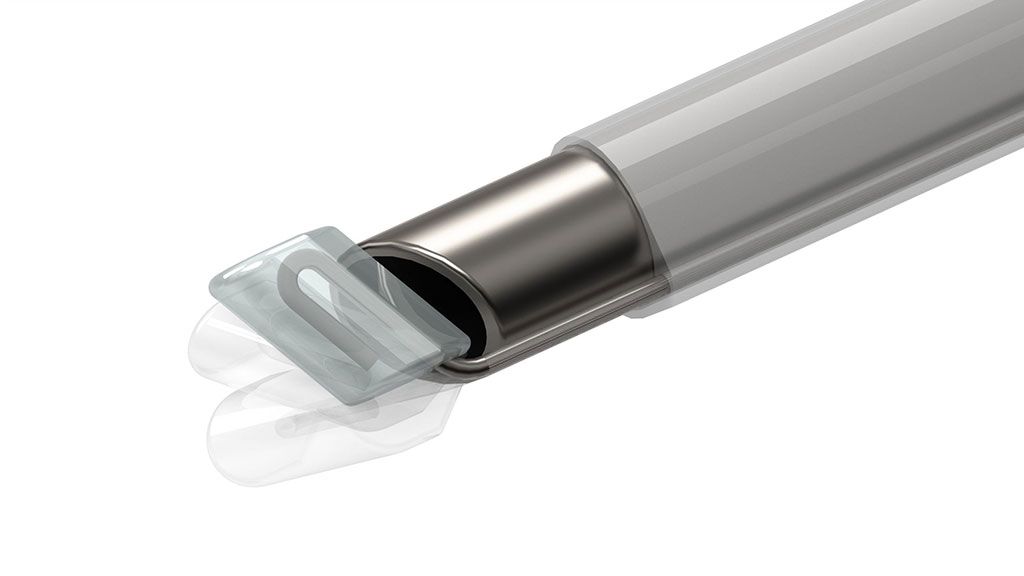 Imagen: La punta rápida del dispositivo Kelling limpia la lente laparoscópica (Fotografía cortesía de ClearCam)