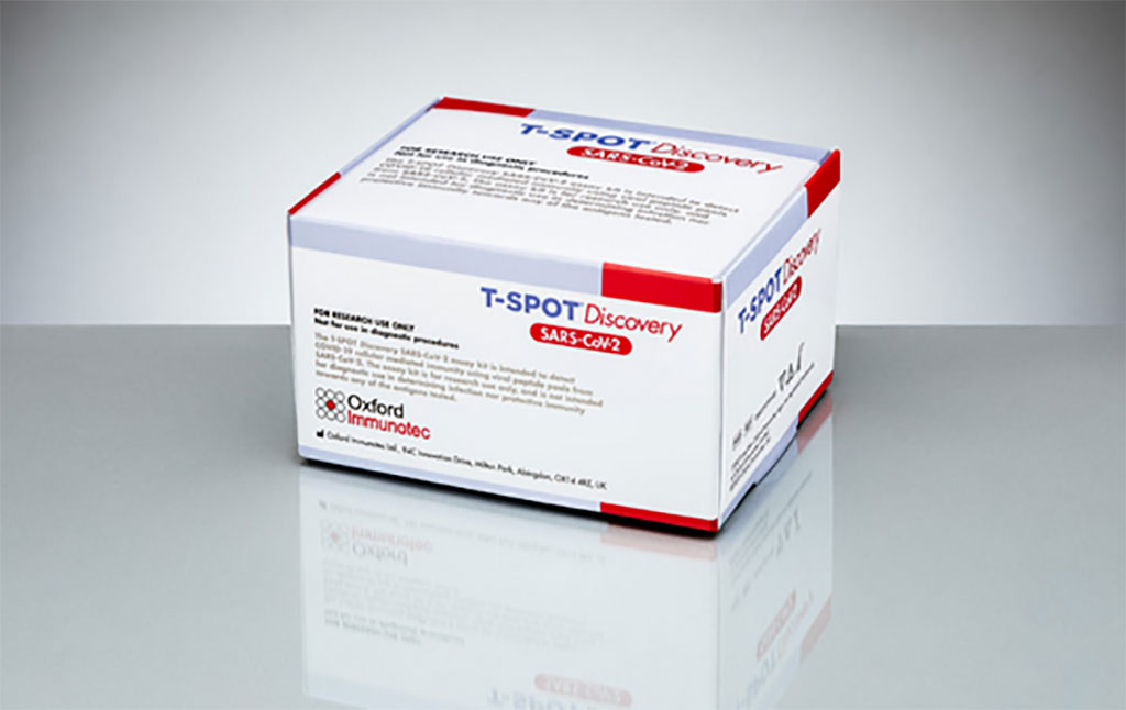 Imagen: Kit T-SPOT Discovery SARS-CoV-2 (Fotografía cortesía de Oxford Immunotec Ltd.)