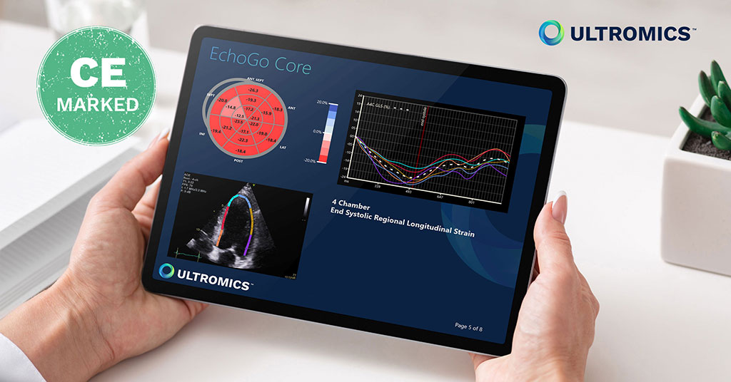 Imagen: EchoGo Core (Fotografía cortesía de Ultromics Limited)