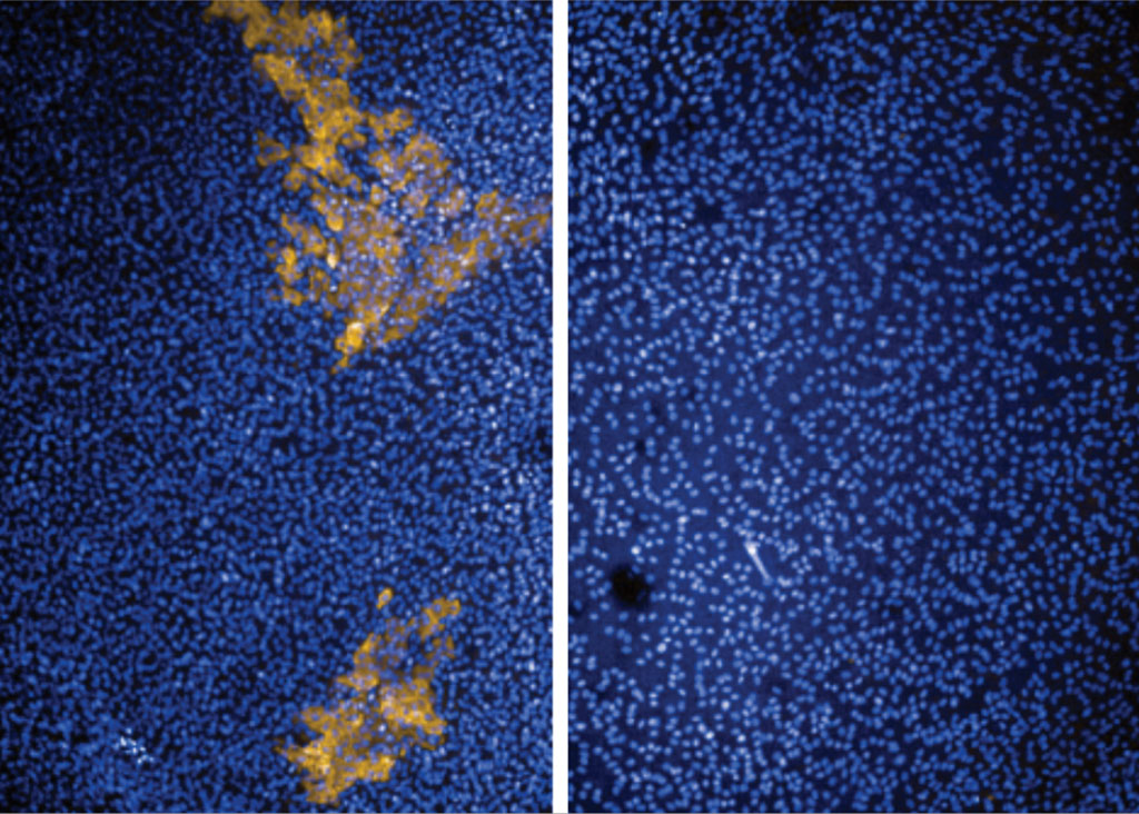 Imagen: Como se ve aquí con microscopía, las células epiteliales pulmonares infectadas con SARS-CoV-2 (izquierda, amarillo) fueron tratadas con éxito con el agonista de STING diABZI (derecha) por investigadores de Penn Medicine (Fotografía cortesía de Penn Medicine)