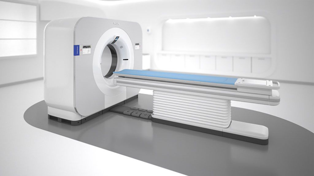Imagen: El Spectral CT 7500 ofrece valiosos conocimientos clínicos (Fotografía cortesía de Philips) Imagen: El Spectral CT 7500 ofrece valiosos conocimientos clínicos (Fotografía cortesía de Philips)