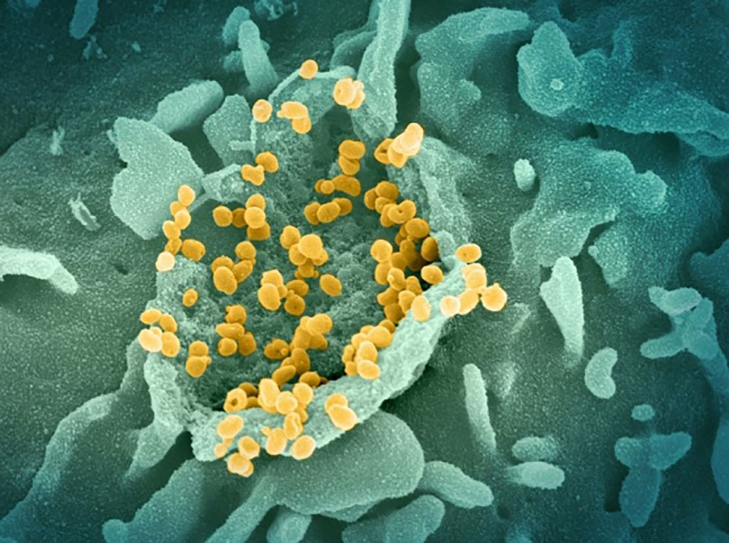Imagen: SARS-CoV-2 en la superficie de una célula cultivada (Fotografía cortesía de NIAID)