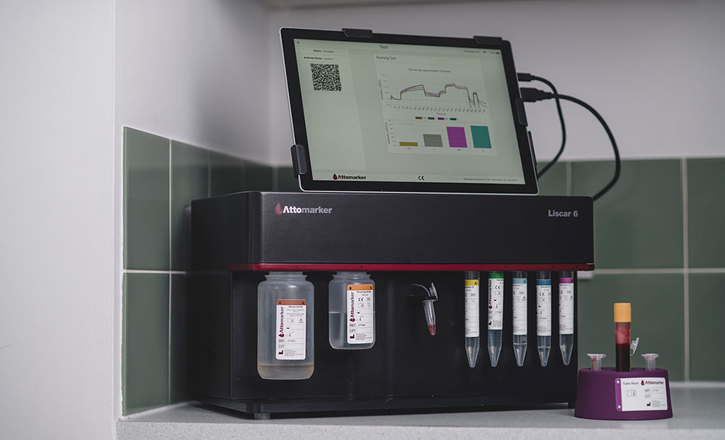 Imagen: El dispositivo de prueba de tres anticuerpos para la COVID-19 indica una infección previa por SARS-CoV-2 y si su vacuna funcionó (Fotografía cortesía de Mantracourt Electronics Limited)