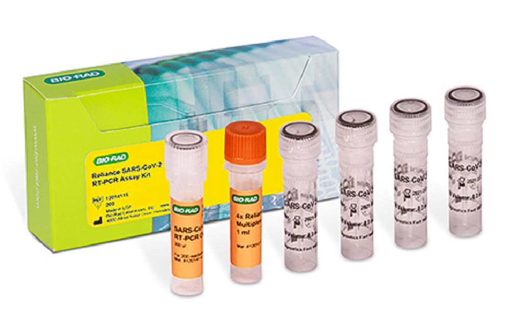 Imagen: Kit de ensayo Reliance SARS-CoV-2 RT-PCR (Fotografía cortesía de Bio-Rad Laboratories, Inc.)