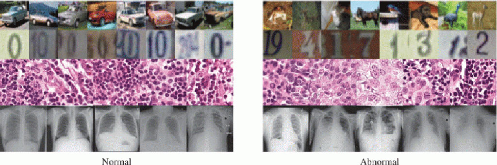 Imagen: Herramienta deIA que detecta anomalías en imágenes médicas podría ayudar a los médicos a detectar el inicio de la neumonía COVID-19 en rayos X (Fotografía cortesía de Nina Shvetsova et al./IEEE Access)