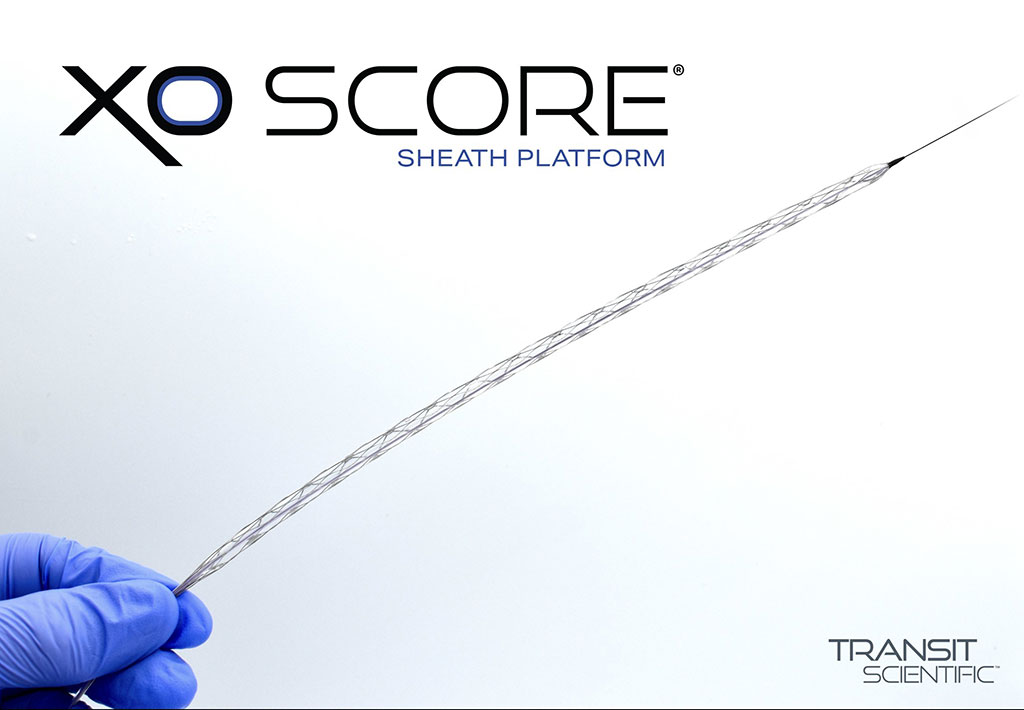 Imagen: XO Score inflado con un balón PTA estándar disponible (Foto cortesía de Transit Scientific)