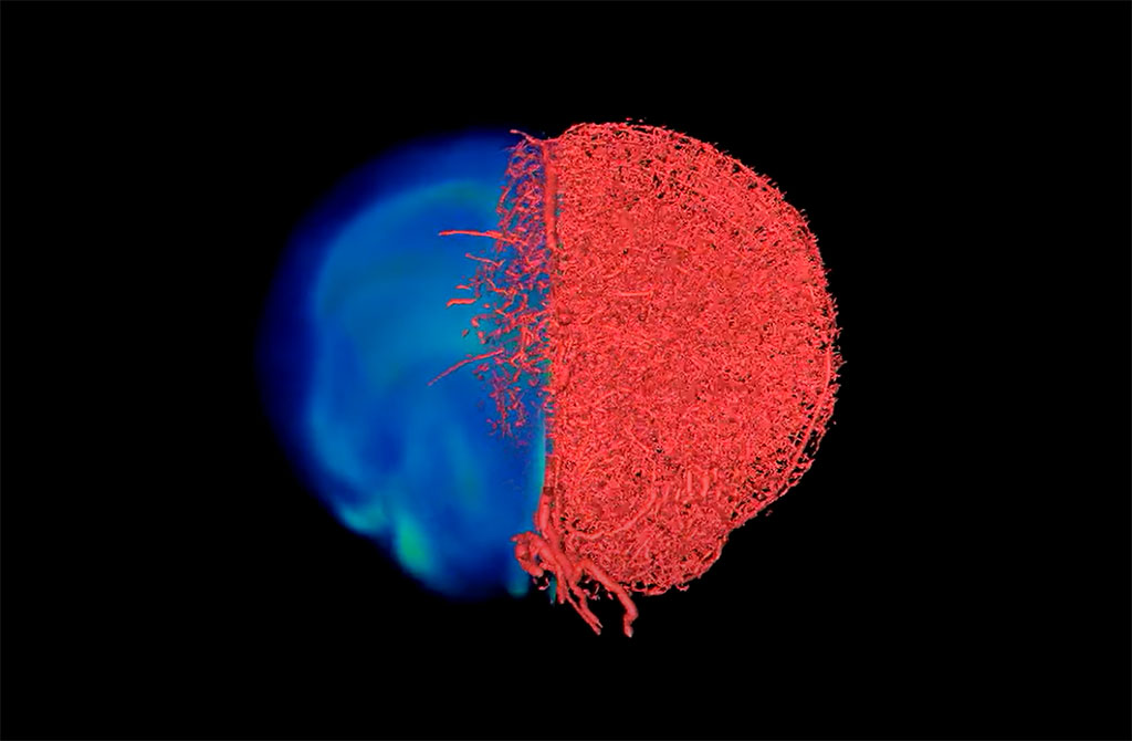 Imagen: Flujo de imágenes de VascuViz (Fotografía cortesía de Johns Hopkins Medicine) Imagen: Flujo de imágenes de VascuViz (Fotografía cortesía de Johns Hopkins Medicine)