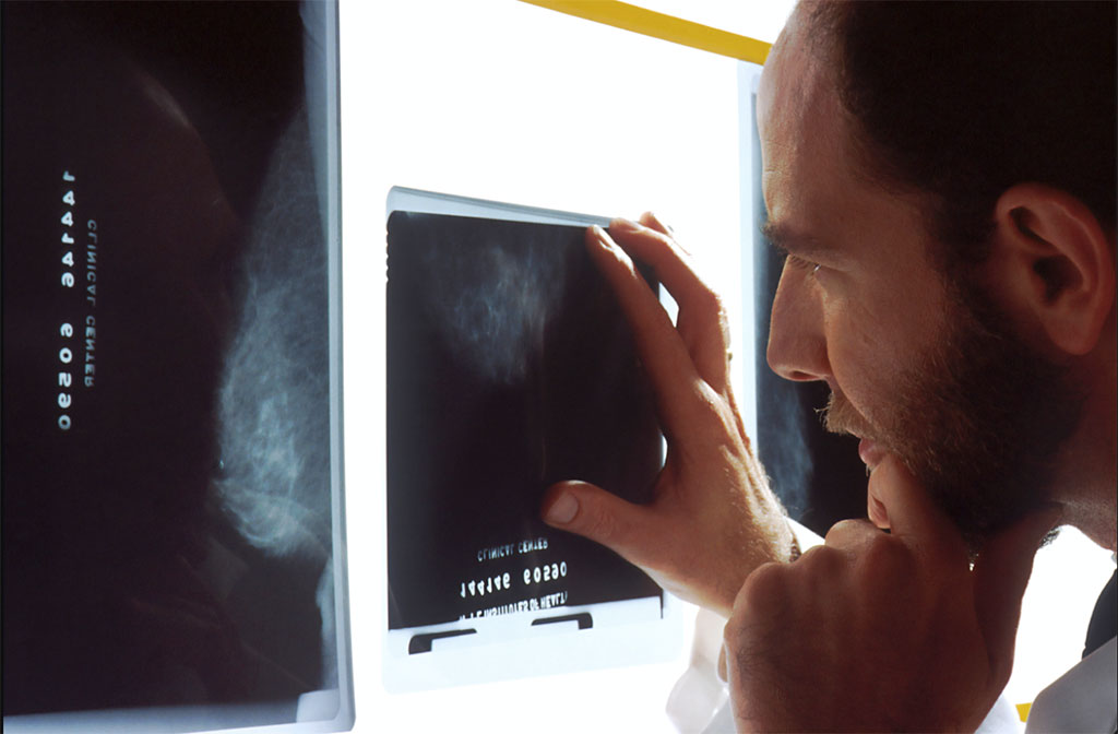 Imagen: ChestLink es el primer producto de imágenes médicas de IA completamente autónomo (Fotografía cortesía de Unsplash) Imagen: ChestLink es el primer producto de imágenes médicas de IA completamente autónomo (Fotografía cortesía de Unsplash)