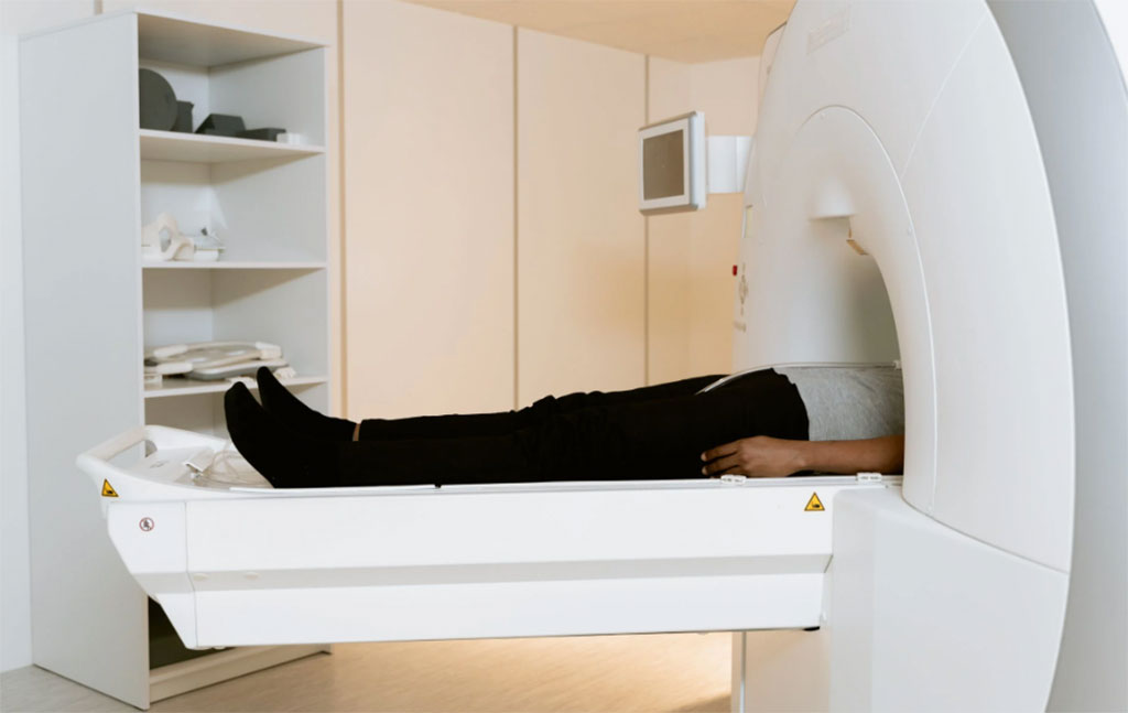 Imagen: La IA podría detectar el cáncer de páncreas de las tomografías computarizadas abdominales (Fotografía cortesía de Pexels) Imagen: La IA podría detectar el cáncer de páncreas de las tomografías computarizadas abdominales (Fotografía cortesía de Pexels)