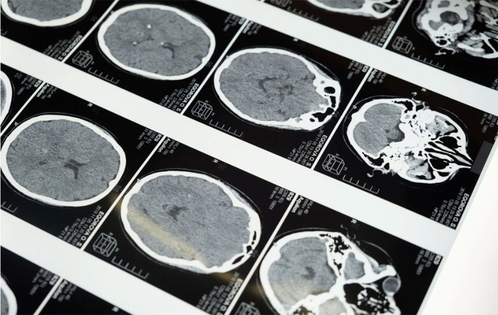 Imagen: La resonancia magnética identifica marcadores del desarrollo atípico del cerebro en niños nacidos prematuros (Fotografía cortesía de Pexels) Imagen: La resonancia magnética identifica marcadores del desarrollo atípico del cerebro en niños nacidos prematuros (Fotografía cortesía de Pexels)