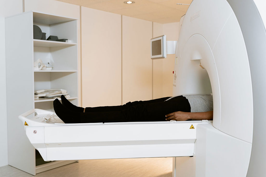 Imagen: La fMRI se puede usar como método no invasivo para predecir complicaciones en la enfermedad hepática crónica (Fotografía cortesía de Pexels) Imagen: La fMRI se puede usar como método no invasivo para predecir complicaciones en la enfermedad hepática crónica (Fotografía cortesía de Pexels)