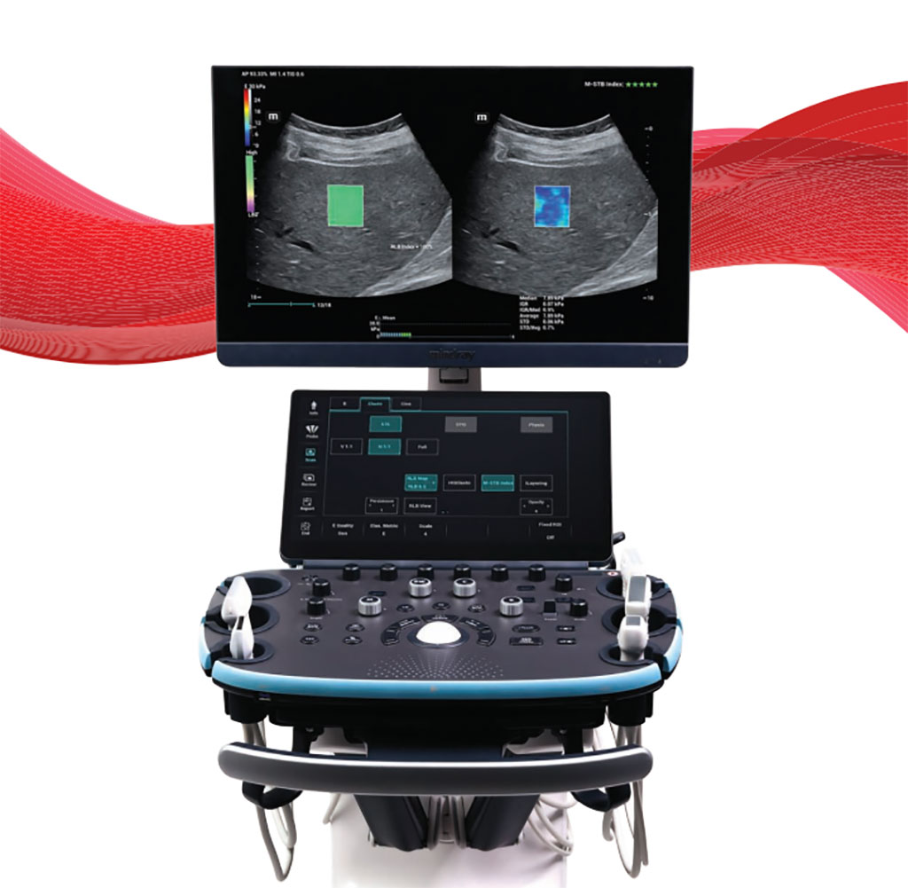 Imagen: El sistema de ultrasonido Resona I9 presenta elementos de diseño innovadores (Fotografía cortesía de Mindray) Imagen: El sistema de ultrasonido Resona I9 presenta elementos de diseño innovadores (Fotografía cortesía de Mindray)