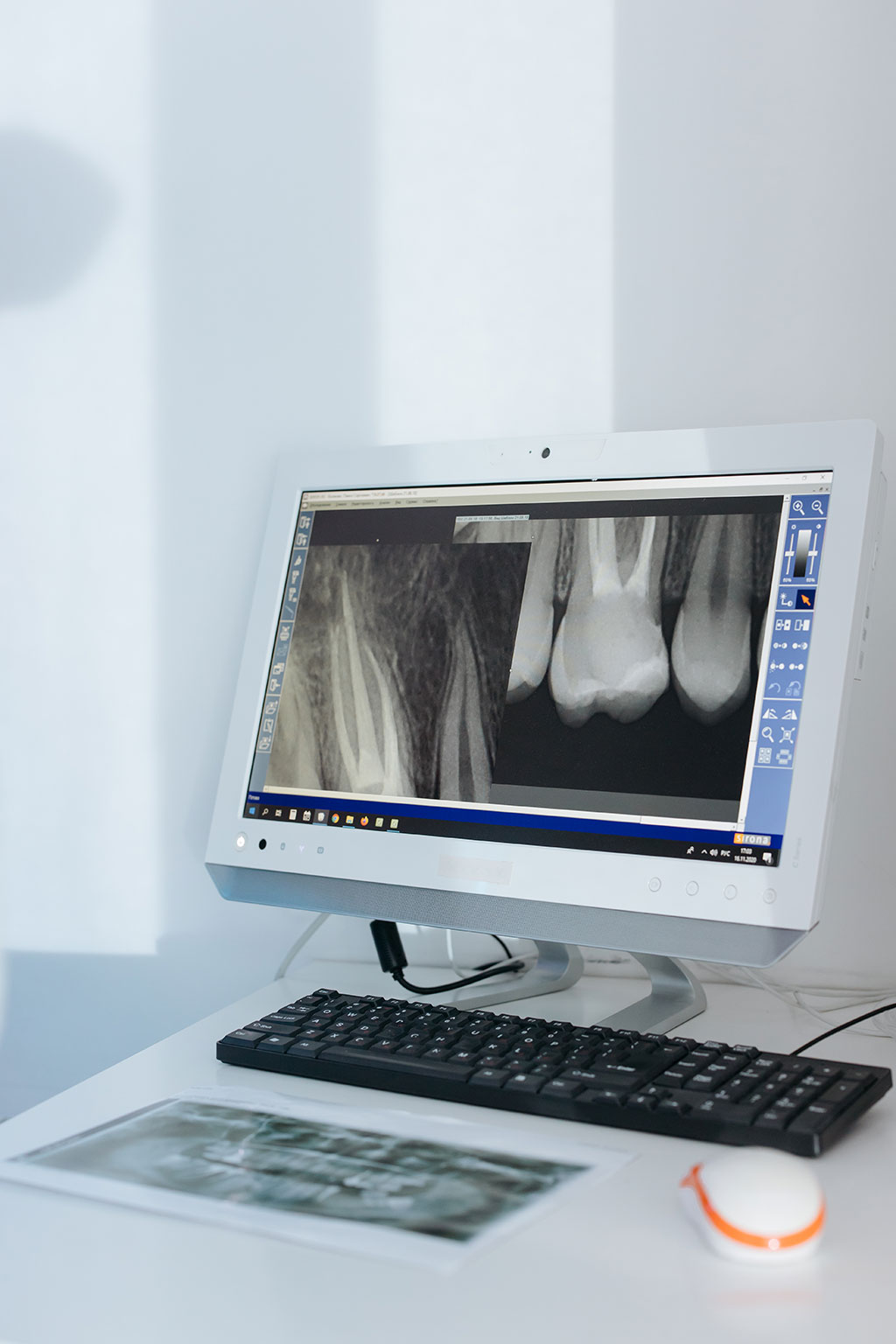 Imagen: Un modelo de IA puede diagnosticar automáticamente la osteoporosis a partir de radiografías de la cadera (Fotografía cortesía de Pexels) Imagen: Un modelo de IA puede diagnosticar automáticamente la osteoporosis a partir de radiografías de la cadera (Fotografía cortesía de Pexels)