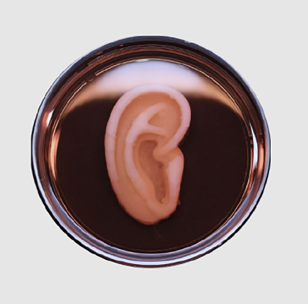 Imagen: Imagen real de la oreja "viva" AuriNovo  impresa en 3D para la reconstrucción en pacientes con microtia (Fotografía cortesía de 3DBio Therapeutics)