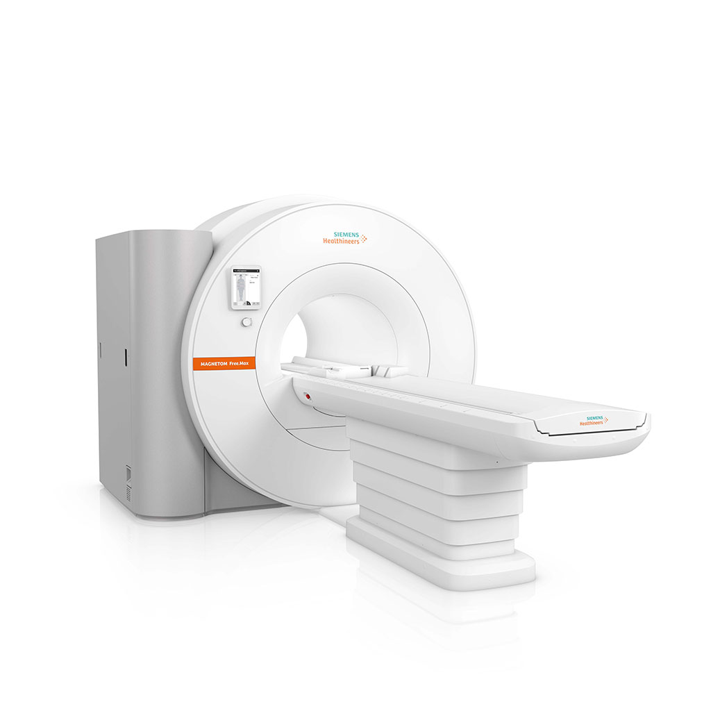 Imagen: Magnetom Free.max es un nuevo escáner de resonancia magnética (RM) High-V (Fotografía cortesía de Siemens Healthineers) Imagen: Magnetom Free.max es un nuevo escáner de resonancia magnética (RM) High-V (Fotografía cortesía de Siemens Healthineers)