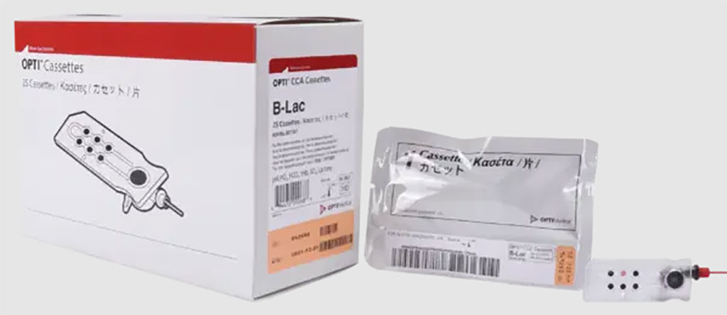 Imagen: El casete B-Lac puede ser una herramienta importante de diagnóstico para casos graves de COVID-19 (Fotografía cortesía de OPTI Medical)