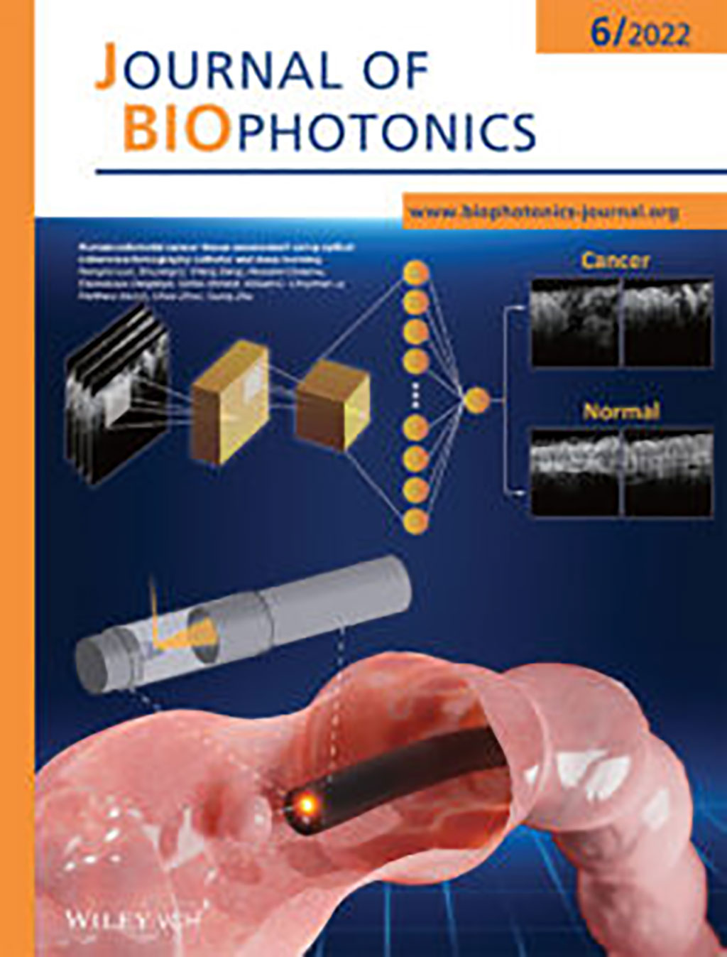 Imagen: Los resultados se publicaron en la edición de junio de la revista Journal of Biophotonics (Fotografía cortesía de la Universidad de Washington en St. Louis)