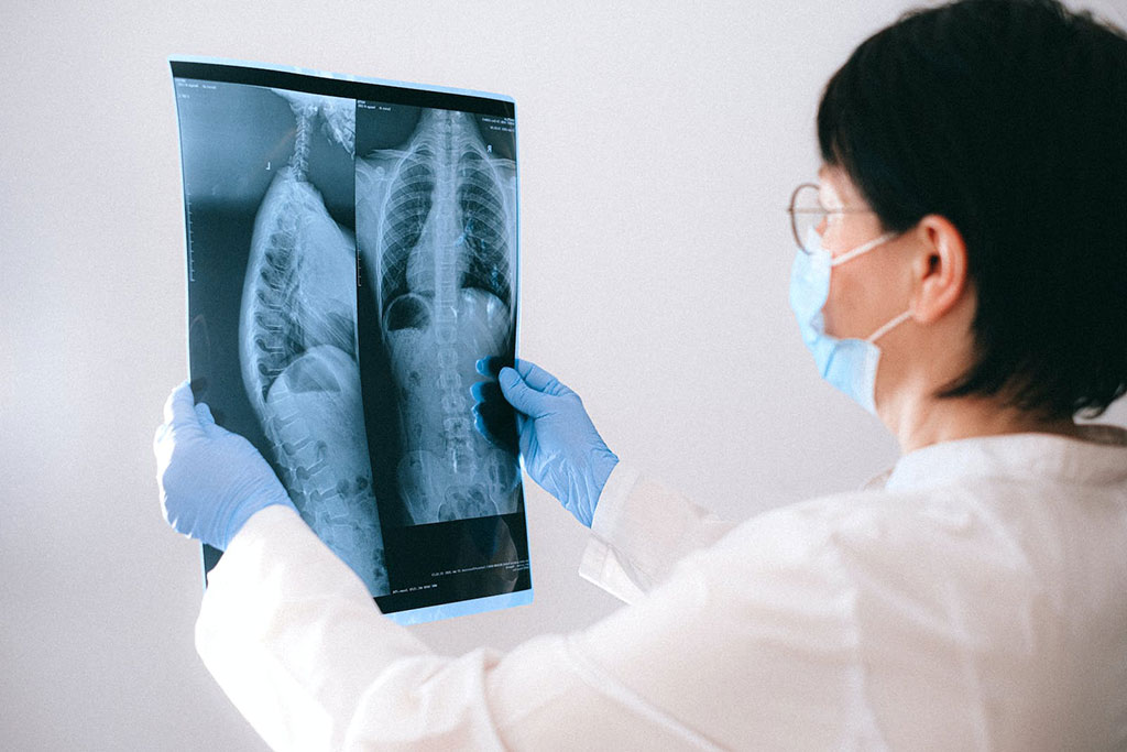 Imagen: La interpretación de la radiografía de torax asistida por IA mejora el rendimiento y la eficiencia del lector (Fotografía cortesía de Pexels) Imagen: La interpretación de la radiografía de torax asistida por IA mejora el rendimiento y la eficiencia del lector (Fotografía cortesía de Pexels)