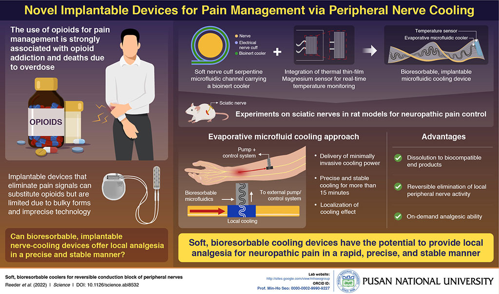 Imagen: Un dispositivo suave, biorresorbible e implantable bloquea las señales de dolor de los nervios periféricos (Fotografía cortesía de la Universidad Nacional de Pusan)